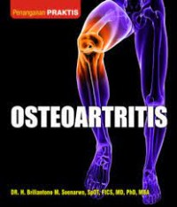 Image of OSTEOARTRITIS